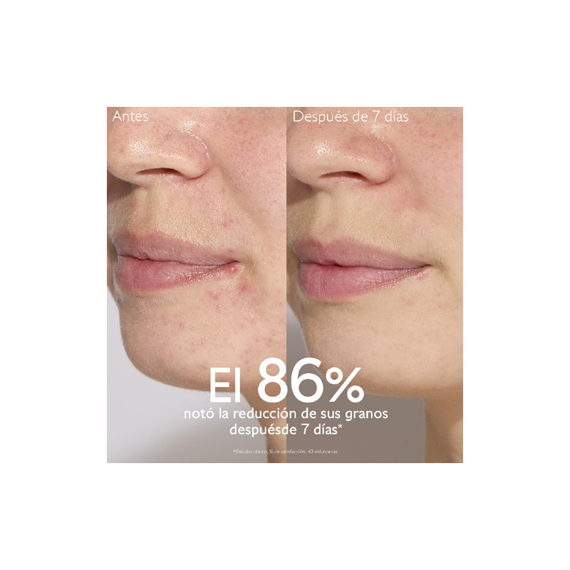 Caudalie Vinopure Serum Salicilico Anti-Imperfecciones 30ml