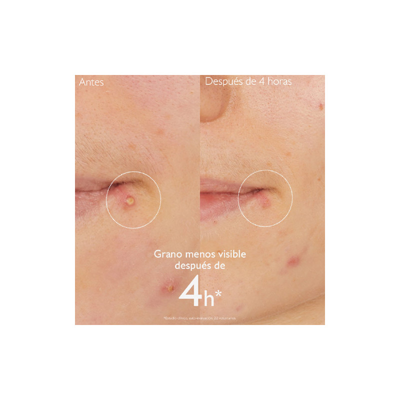 Caudalie Vinopure Stop Granos Salicilico 15ml