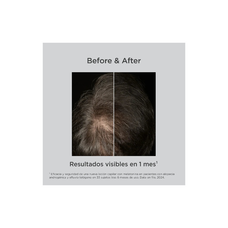 Isdin Lambdapil Anticaida Melatonin Concentrate Locion 100ml