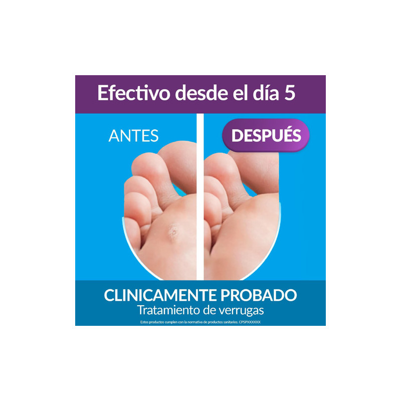 Excilor Verrugas Duo Power Tratamiento Extra Fuerte Crio + Acido