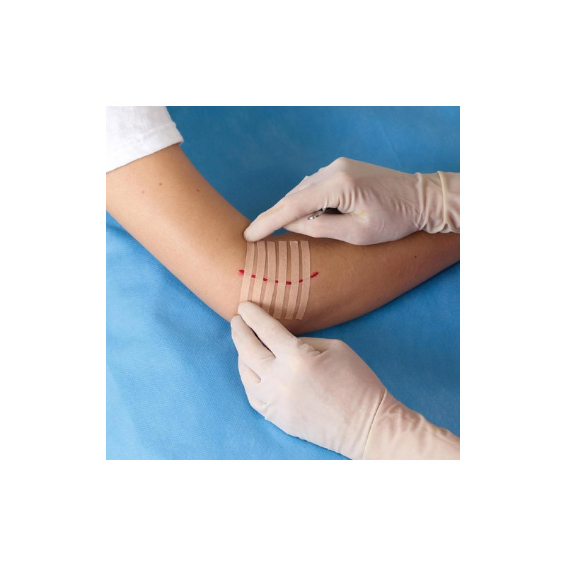 Nexcare Steri-Strip Suturas Cutaneas Cutaneas Color Carne 6Uds