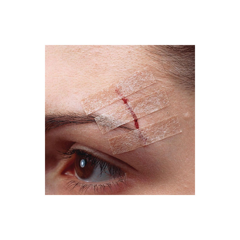 Nexcare Steri-Strip Suturas Cutaneas Cutaneas Color Carne 6Uds