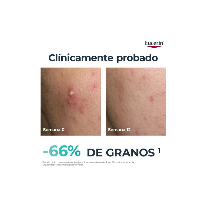 Eucerin Dermopure Clinical Serum Triple Accion 40ml - Farmacia en Casa Online
