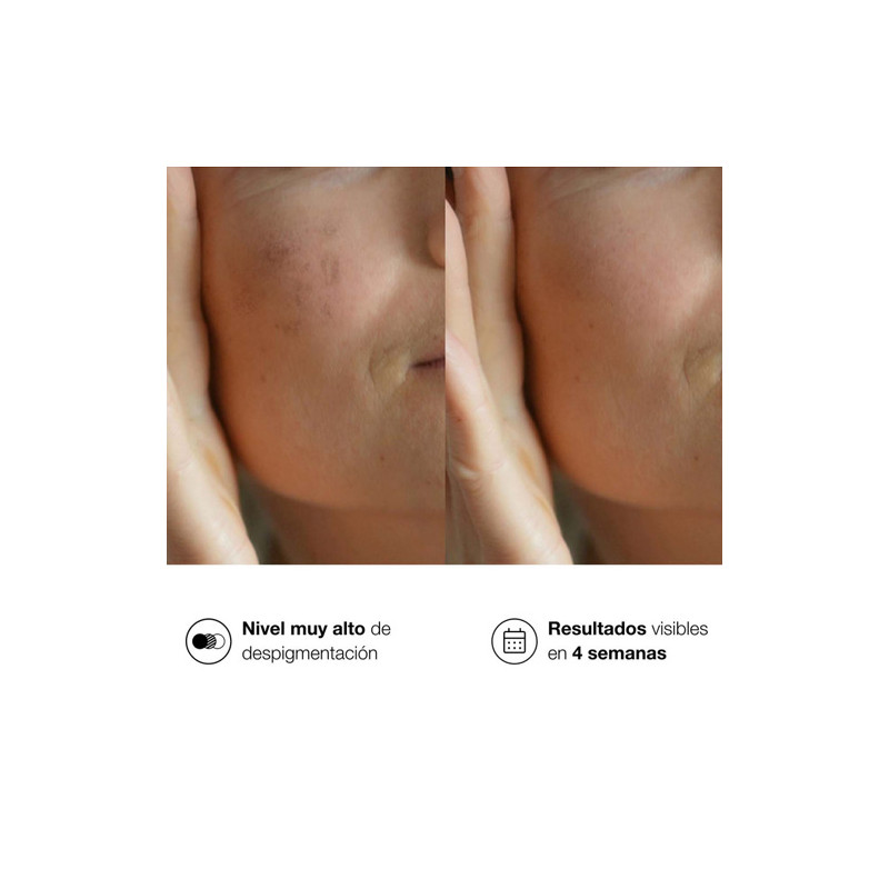 Bella Aurora Bio10 Forte Tratamiento Despigmentante L-Tigo 30ml