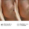 Bella Aurora Bio10 Forte Tratamiento Despigmentante L-Tigo 30ml